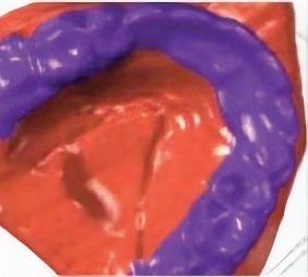 upscalemedia-transformed (6)